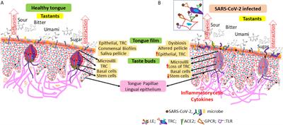 Taste Dysfunction and Long COVID-19